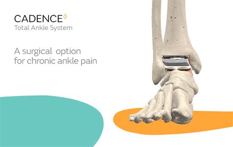 cadence total ankle